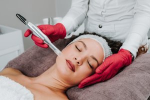 Get Glowing: Expert Microneedling Services at Pia Esthetics Tampa