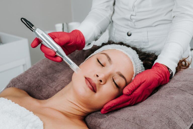 Get Glowing: Expert Microneedling Services at Pia Esthetics Tampa